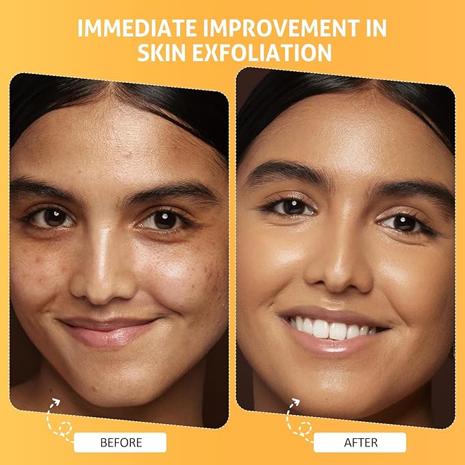 Pumpkin Enzyme Face Mask Skincare| Brightening Exfoliating Facial Mask For Dead Skin,Dullness Dark Spots, Uneven Skin Tone,Large Pores and Brightens Skin,Gift for Him & Her,100g/ 3.52 oz