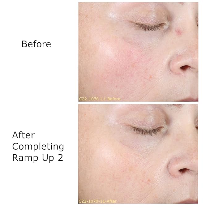 Hydrate & Soothe Beauty Collection Gift Bundle/Starter Kit, Activator with 0.05% Retinol Cream, Ramp-Up Regimen 2 & RHR Overnight Mask, Skin Care Routine, For All Skin Type