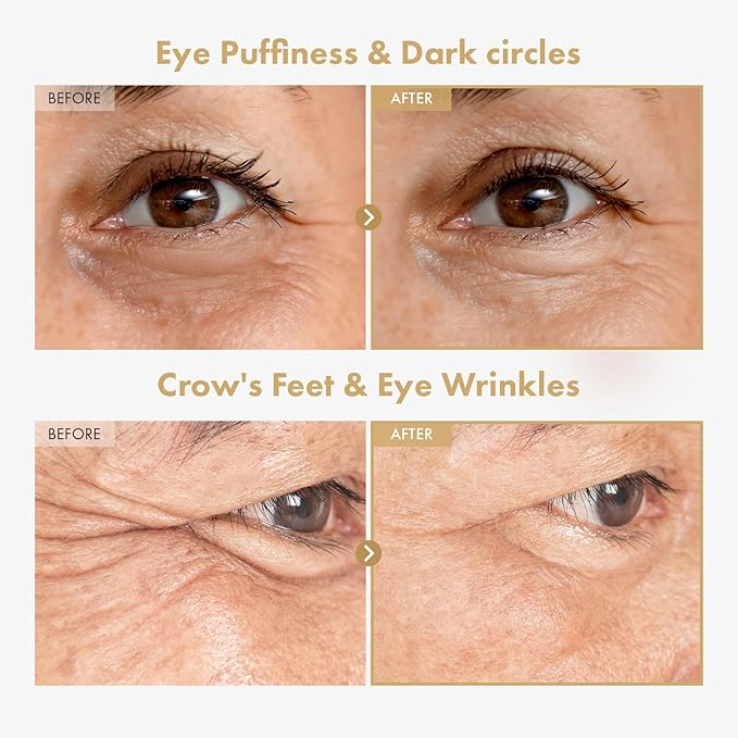 Ginseng Plus Retinal Eye Serum with Retinal Niacinamide Bakuchiol Correction for Puffy Eye Bags Fine Lines Dark Circles Wrinkles, Korean Skin Care, 30ml, 1.01 fl.oz.