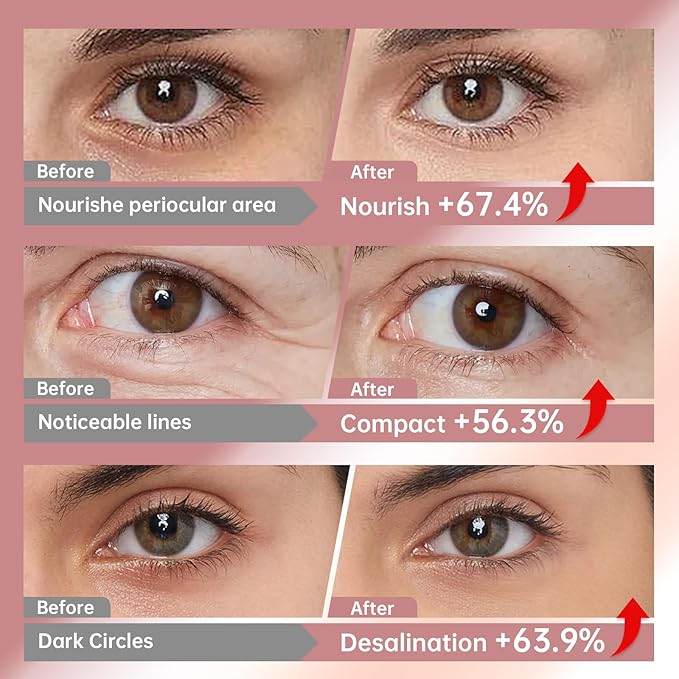 Novoy 7 Pairs Bio-Collagen Real Deep Eye Patches - 6-in-1 Retinol Overnight Eye Patches for Dark Circles, Puffiness & Wrinkles | 2% Caffeine+Hyaluronic+Niacinamide, Korean Popular Eye Mask - ROSE