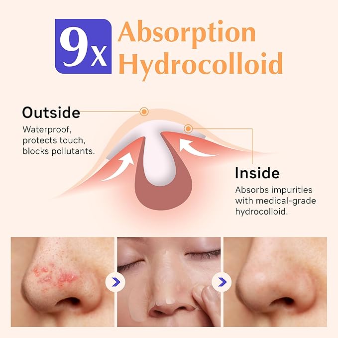 Pimple Patches,Hydrocolloid Acne Patches for Nose,Overnight Pimple Pore Stickers,Zits & Blemish,Clear Skin,Control & Absorb Oil,Cover Acne Blemishes, Nose Patches for Black Heads(10 Count)