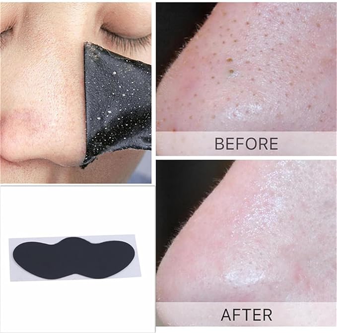 10Pcs Blackhead Remover Pore Strips Black Head Remover for Face, Pore Cleaner for Nose Area Face Oil Blackheads Black,Beauty and Personal Care Pore Cleansing Strips,Treatments and Masks