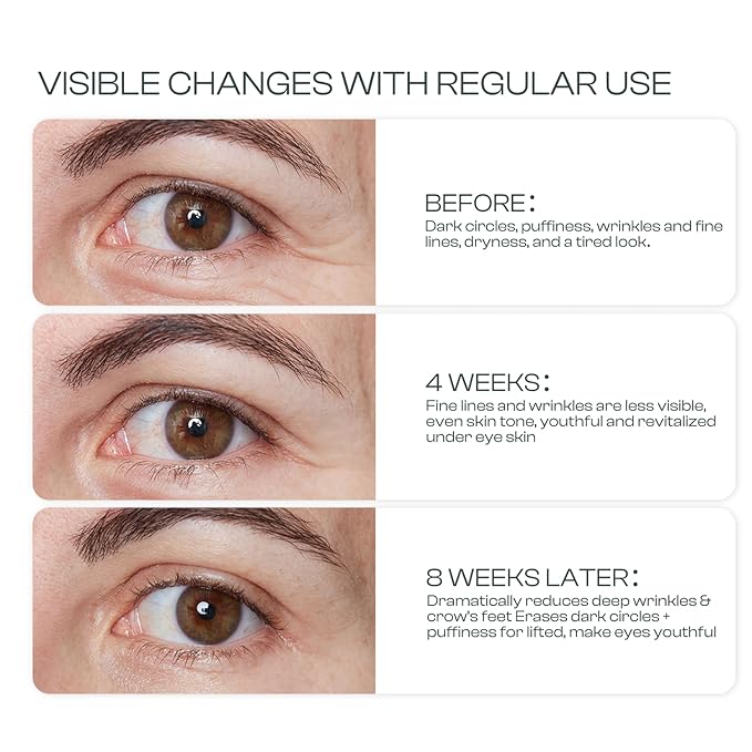 Eye Cream for Dark Circles: Caffeine Eye Cream with Hyaluronic Acid Vitamin E collagen For anti-aging dark circles eye bags puffiness Eye Lift Treatment For Men Women Day and Night 1.87oz