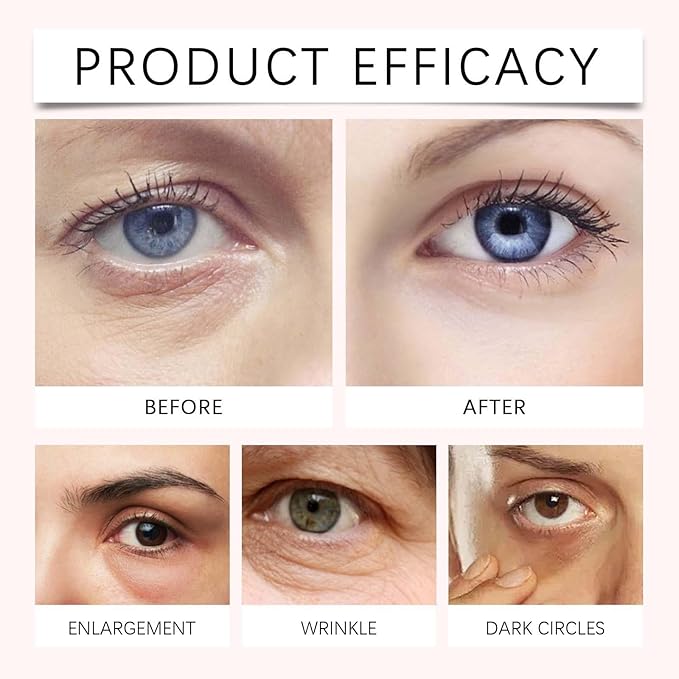 PDRN Pink Peptide Eye Serum Cream, Hydrating & Firming Eye Cream for Dark Circles, Anti-Aging Treatment Reduces Fine Lines, Uneven Skin Tone, Soothing Pink Moisturizer with Peptides, 1.01fl.oz (2)