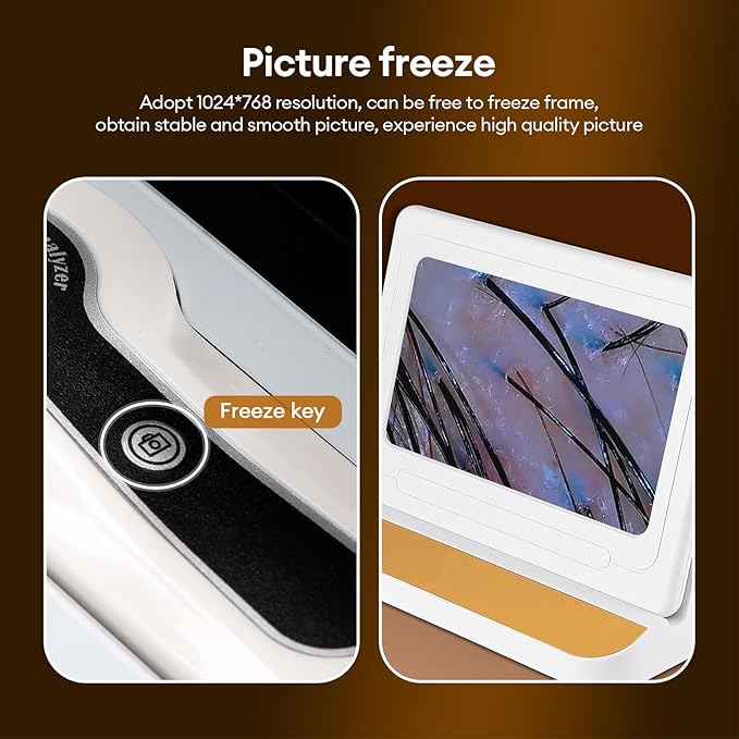 Scalp Analysis Machine, 11 Inch HD Screen Skin Hair Analyzer, Digital Hair Follicle Scalp Detector with 50x/200x DualHeads for Home Salon Use,No APP Needed