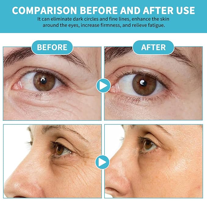 Anti-Aging Eye Cream for Wrinkles Under Eye Cream with Snail Mucin for Fine Lines Puffiness - Firming Eye Serum Relieve Eye Fatigue for Women