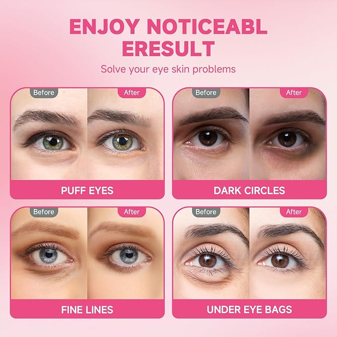 POSTA 20Pairs/40Pcs Collagen Under Eye Patches, Glitter Under Eye Mask for Dark Circles and Puffiness, Hydrating Eye Skincare Reduce Wrinkles and Fine Lines, Eye Gels Pads for Beauty Personal Care