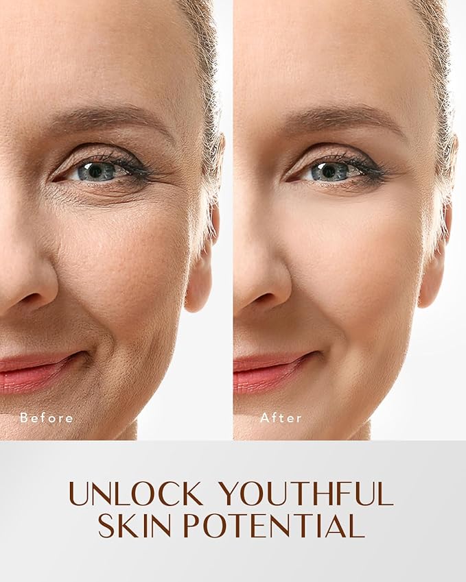 EnaSkin Retinol Collagen Face Moisturizer: Anti Aging & Wrinkle Repair Cream for Women - 7% Hyaluronic Acid Boost Hydration Formula - Facial Neck Day/Night Firming & Lifting, 1.7 Fl Oz