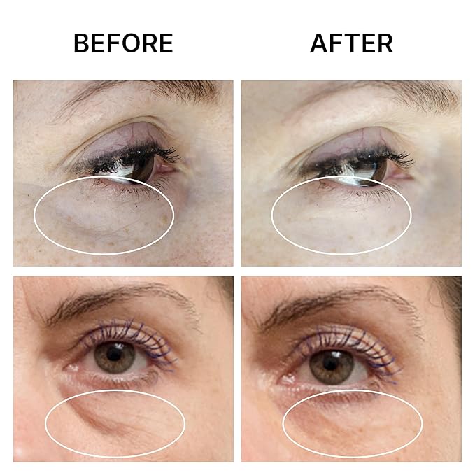 PUFFINESS AWAY Eye Cream 0.8 fl.oz - Instant Eye Bag Remover Puffiness with Eyeliss; Vitamin C, Under Eye Puffiness Reducer Instant Results, Temporary Reduction of Wrinkles & Dark Circles