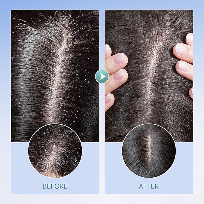 Scalp Exfoliating Scrub, Sea Salt Cleansing Scalp Scrub Shampoo, Relieves Itching, Greasy Or Dry Scalp and Dandruff, Contain A Scalp And Hair Care Massager