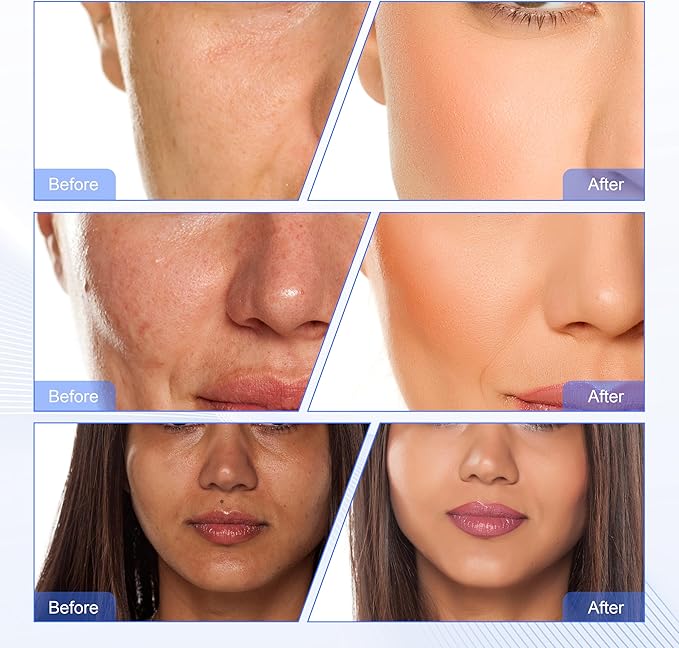 Elitzia 2 in 1 Hydro Dermabrasion Diamond Microdermabrasion Machine Skin Peeling Water Beauty Machine Water Peel System Skin Cleansing ETWD006