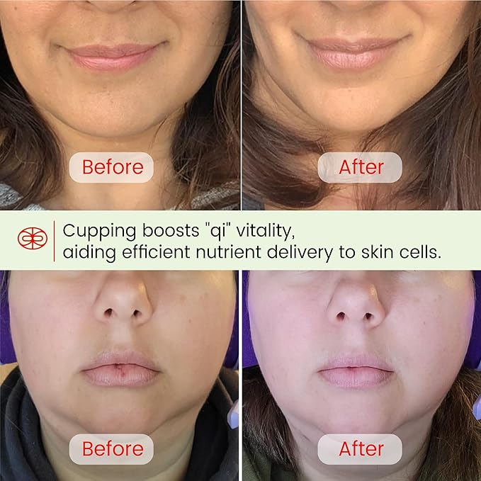 Rena Chris Facial Cupping Set & Gua Sha Facial Tool - Silicone Cupping Set & Jade Gua Sha Stone - Face Cupping Therapy Set for Natural Skin Care, Puffiness, Lip Plumping(Green)