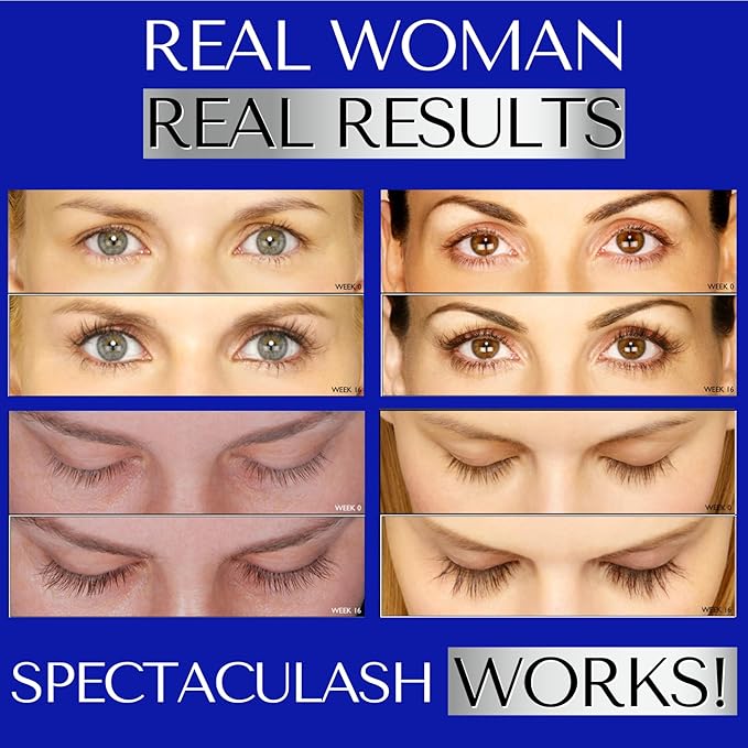 SPECTACULASH XL RAPID LASH SERUM for Eyelash Growth Serum to Grow Long Natural Lashes – Grow Long Eye Lashes – Lash Conditioner – Eyelash Volume - Suero Para Pestañas Crecimiento by DERMAWORKS