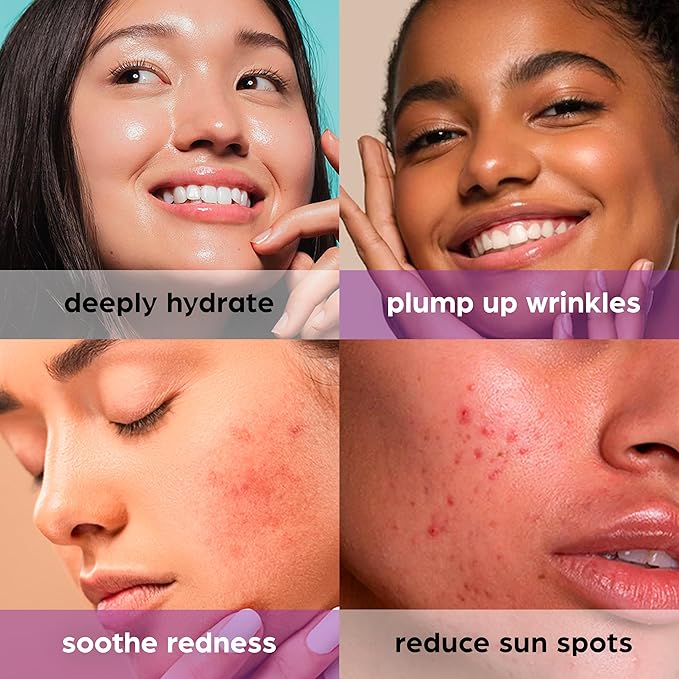 50% Beta Glucan Serum | Mothers Day Gifts for Mom | Anti-Aging, Plumping for Dry Skin, Fine Lines, Wrinkles, Dark Spots | Niacinamide, Centella, Hyaluronic Acid | Korean Skincare | Non-Greasy