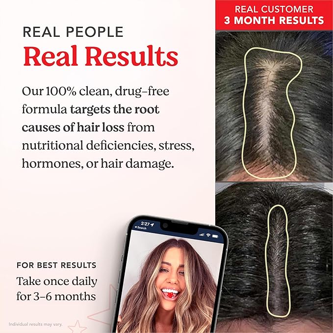 HAIRtamin Vegan Gummy Stars Hair Vitamins | Non-GMO | All Natural Biotin Hair Vitamin Gummies to Maintain Healthy Hair Skin & Nails | Multivitamin Supplement