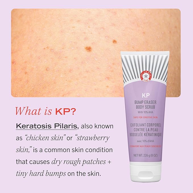 First Aid Beauty - KP Bump Eraser Body Scrub with 10% AHA, Keratosis Pilaris Skin Exfoliater with Glycolic and Lactic acids, Helps Reduce Chicken Skin Bumps, Safe for Sensitive Skin, 8 oz, 2ct