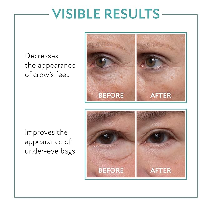 Westmore Beauty 60 Second Eye Effects Tinted Firming Gel - Instant Tightening Serum, Under-Eye Cream for Puffiness and Bags - Light to Medium, 0.33 Fl Oz (10 mL)