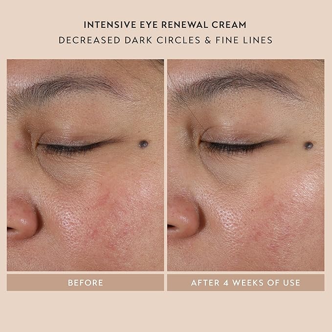 SHANI DARDEN SKIN CARE Skin Renewal Trio, Includes Hydration Peptide Cream, Retinol Reform & Deluxe Intensive Eye Cream, Limited Edition 3-Piece Set