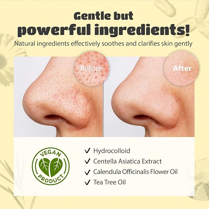 lattcare Calendula Nose Pore Strips 6Ct + Dalgona Skin Shield Patches 15Ct | Duo Pack | Blackheads Remover | Blackheads Remover | Pimple Patches | Hydrocolloid Acne Patches | 2 Items of 1 Pack