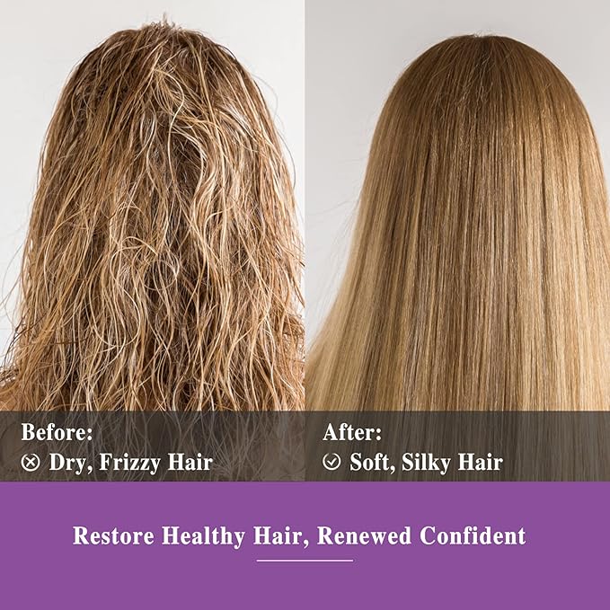 Rosemary Essential Oil 10ML, Pure Essential Oils for Massage, Diffusers, Rosemary Oil for Soap Candle Making (0.33FL.OZ Bottle)