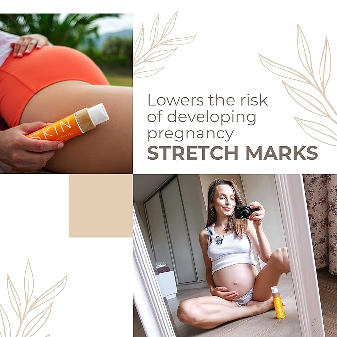 COCOSOLIS SKIN Stretch Mark Dry Oil | Organic Anti Stretch Mark Oil for Pregnancy | Natural Oils + Vitamin E | Rebuilds Skin`s Collagen (110 ml)