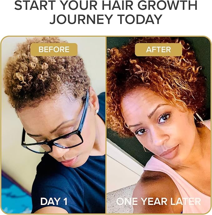 Iconic Natural Hair Vitamins for Fast Hair Growth - Pure Hair Supplements Formulated with Vitamins to Promote Thicker, Stronger Hair - Vegan Hair Care for Hair Loss - Non-GMO (60 Capsules)