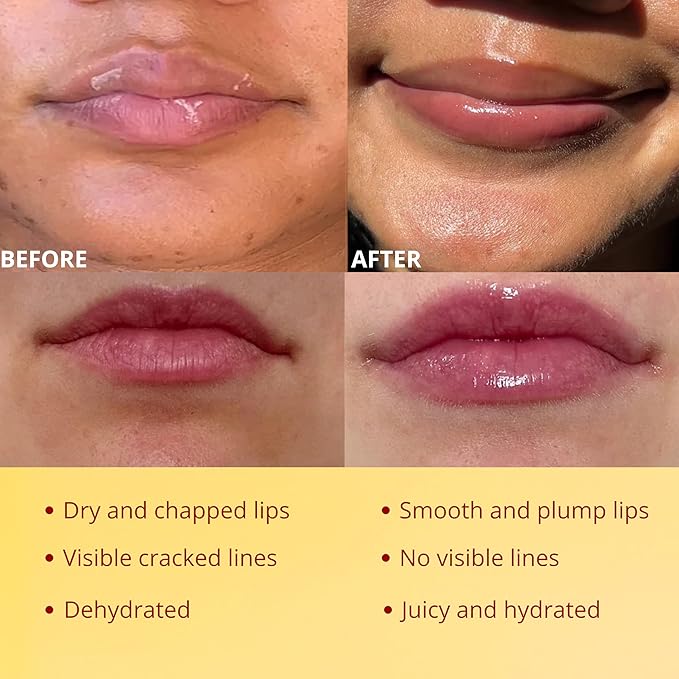 3 Pcs Original My Bee Balm Lip Balm – Hydrating Lip Care with Watermelon, Strawberry & Honey Pot – Moisturizing Balm for Dry, Chapped & Cracked Lips with Propolis, Honey & Vitamin E