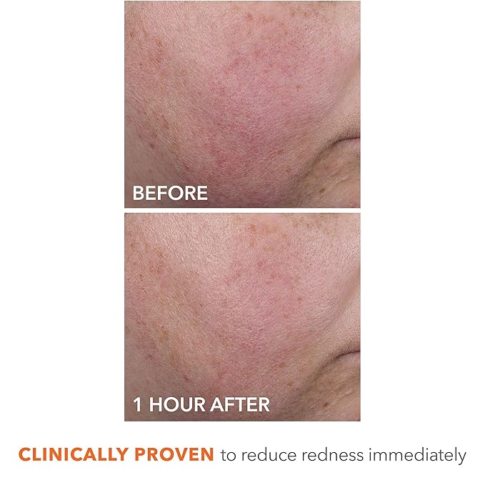 Dr Dennis Gross DermInfusions Blur + Repair Cream, Instantly Blurs Fine Lines, Smooths Skin with Satin-Matte Finish, Visibly Plumps & Firms, Reduces Redness, and Improves Skin Elasticity, 1.7 Fl Oz