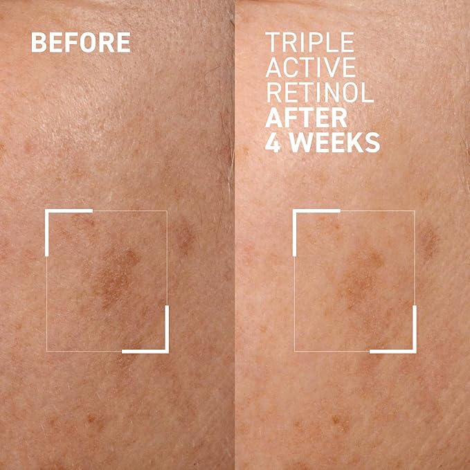 Dr. Brandt Bright This Way Triple Active Retinol - 1 oz, Pack of 2 - Gentle Overnight Renewal Cream - Reduces Wrinkles & Discoloration, Illuminates & Hydrates