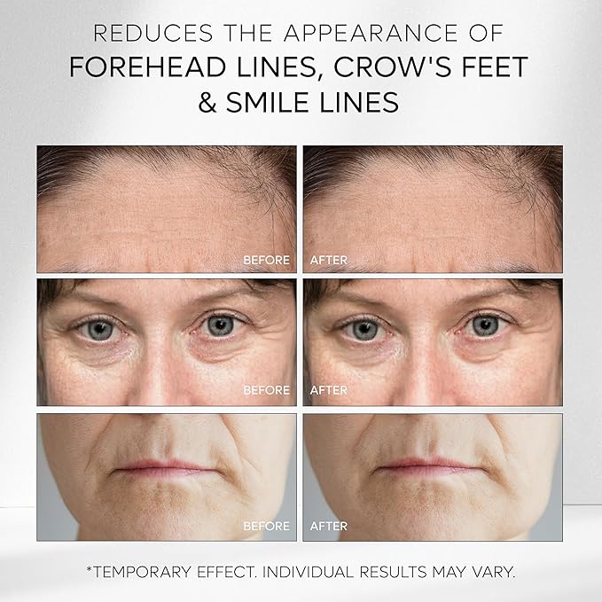 Instant Rapid Face Lift Cream: Temporary Eye Tightener Instant Wrinkle Remover For Face Instant Firming Eye Cream Instant Eye Bag Remover Puffiness - 60 Second Eye Effects 30g