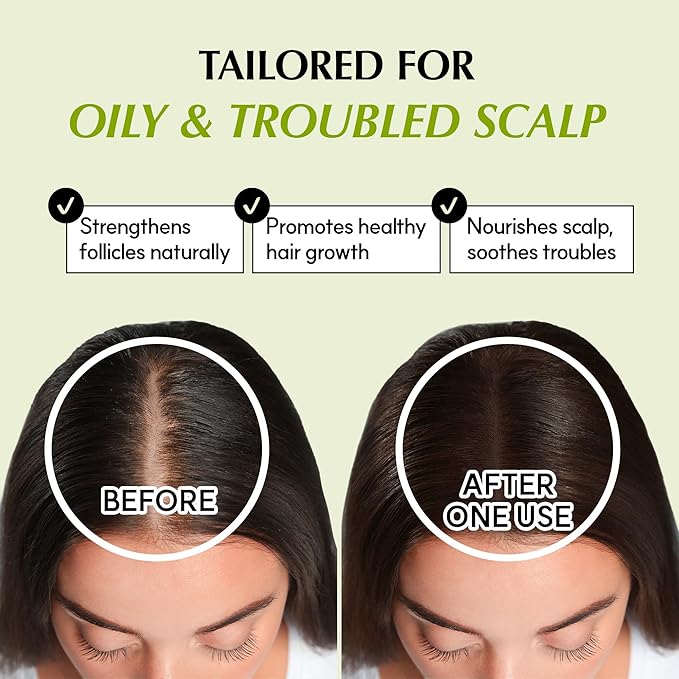 RATED GREEN REAL MARY Energizing Biotin Hair Growth Spray for Thinning Hair and Scalp for Men & Women - Rosemary and Ginger Scalp Spray | 4.06 fl oz