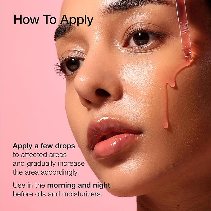 ANUA Niacinamide 10 + TXA 4 Serum, Hyaluronic Acid, Tranexamic acid, Vitamin B12, Facial Serum for Glass Skin, Clarifying, Radiant Complexion with Natural Color, Korean Skin Care (30ml /1.01 fl.oz)