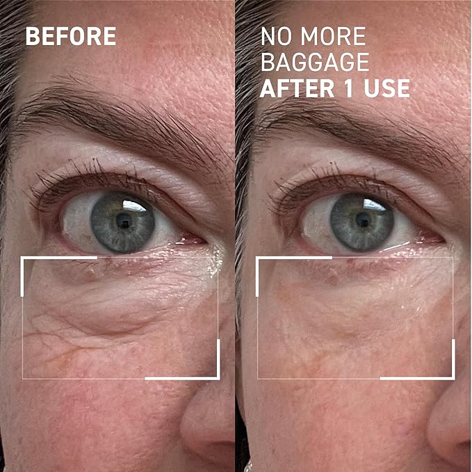 Dr. Brandt Needles No More, No More Baggage - Minimizes Under-Eye Bags, Puffiness & Dark Circles - 0.25 oz