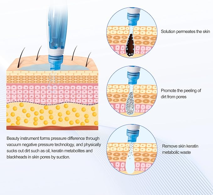 Elitzia 2 in 1 Hydro Dermabrasion Diamond Microdermabrasion Machine Skin Peeling Water Beauty Machine Water Peel System Skin Cleansing ETWD006