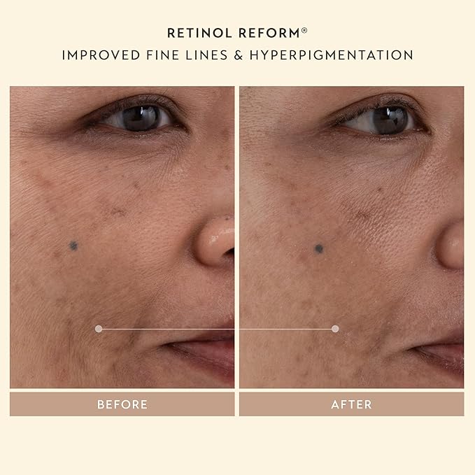 SHANI DARDEN SKIN CARE Skin Renewal Trio, Includes Hydration Peptide Cream, Retinol Reform & Deluxe Intensive Eye Cream, Limited Edition 3-Piece Set