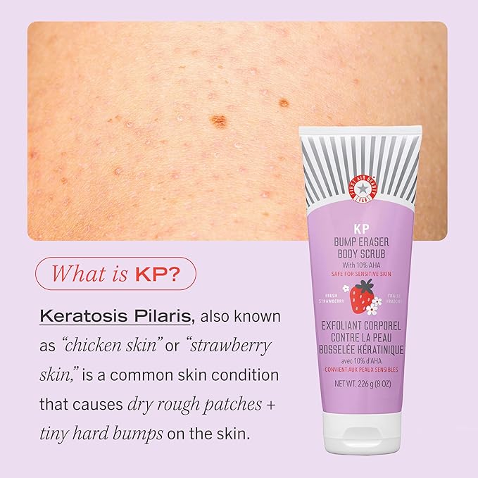 First Aid Beauty - KP Bump Eraser Body Scrub with 10% AHA, Keratosis Pilaris Exfoliator with Glycolic and Lactic acids, Helps Reduce Chicken Skin Bumps, Safe for Sensitive Skin, Strawberry Scent, 2 oz