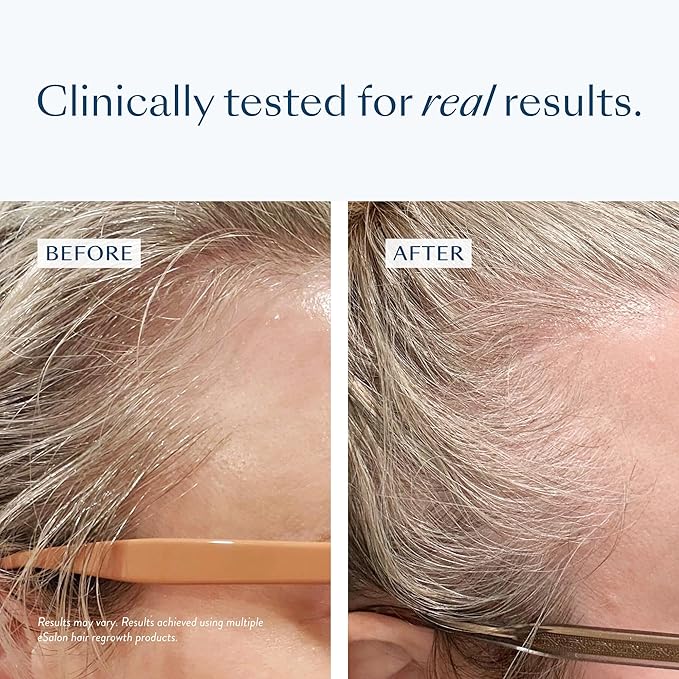 eSalon Biotin Hair Multivitamins with Collagen, 2500mcg, 60 Capsules, 30 Day Supply, Allergen-Free