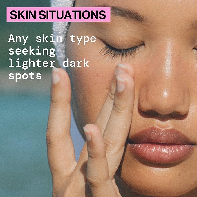 Pacifica Dark Spot Dissolving Micropatches – Microneedling Dots with Niacinamide, Tranexamic Acid & Kale to Fade Post-Acne Marks and Age Spots, Brightening Patch Treatment, Clean Vegan Skincare