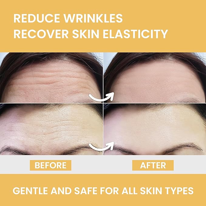 MONIER Forehead Wrinkle Patches Smoothing Overnight - Anti Wrinkle Patches for Face and Forehead Fine Lines & Frown Lines - With Aloe, Collagen, Vitamin E, Hyaluronic Acid | 12 pcs