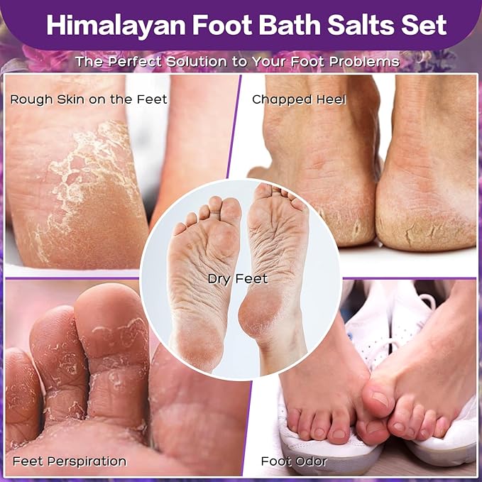 Foot Soak Kit Pack of 3 Natural Epsom Salt Rose- Essential spa Itching,Foot Bath Salt Tea Tree Oil Soak Care Pedicure Feet spa Message Tea Tree Oil