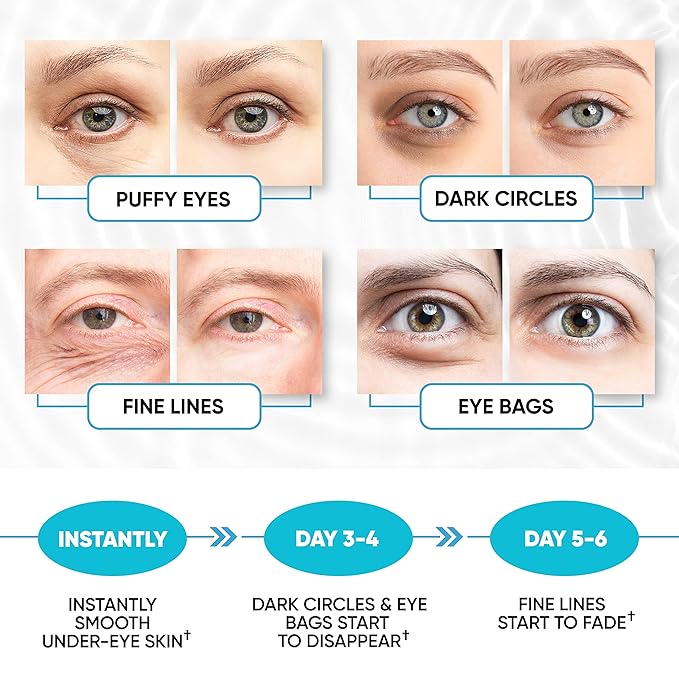 Under Eye Patches for Puffy Eyes, Dark Circles, Dull Skin - Natural Moisturizing Support - Help with Wrinkles and Fine Lines - Under Eye Mask with Hyaluronic Acid, Collagen, Caffeine - 30 Pairs