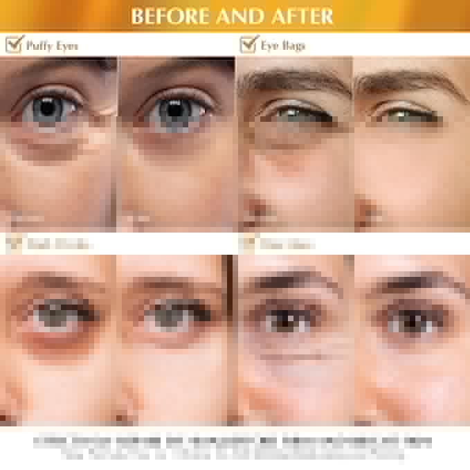 Enaskin Naturals Under Eye Patches Dark Circles Under Eye Masks for Puffiness - 24K Gold Eye Gel Pads Retinol Collagen Hyaluronic Acid Moisturizing & Reducing Wrinkles (24K Gold)