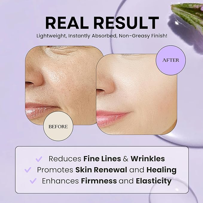 Excuse My Frank Age Defense Bakuchiol Korean Serum, Natural Retinol, Dark Spot Serum, Anti aging, Fine Lines & Wrinkle Care, Collagen Boost, Skin Barrier, Firming, Fragrance Free, Vegan 2.7 fl oz