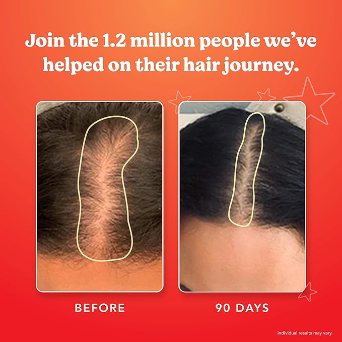 HAIRtamin Vegan Gummy Stars Hair Vitamins | Non-GMO | All Natural Biotin Hair Vitamin Gummies to Maintain Healthy Hair Skin & Nails | Multivitamin Supplement