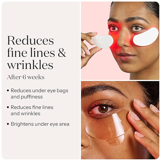 SmoothSkin Under-Eye Red Light Therapy Device, LED Eye Patches with 24 Hydrocolloids, for Dark Circles, Wrinkles & Puffiness