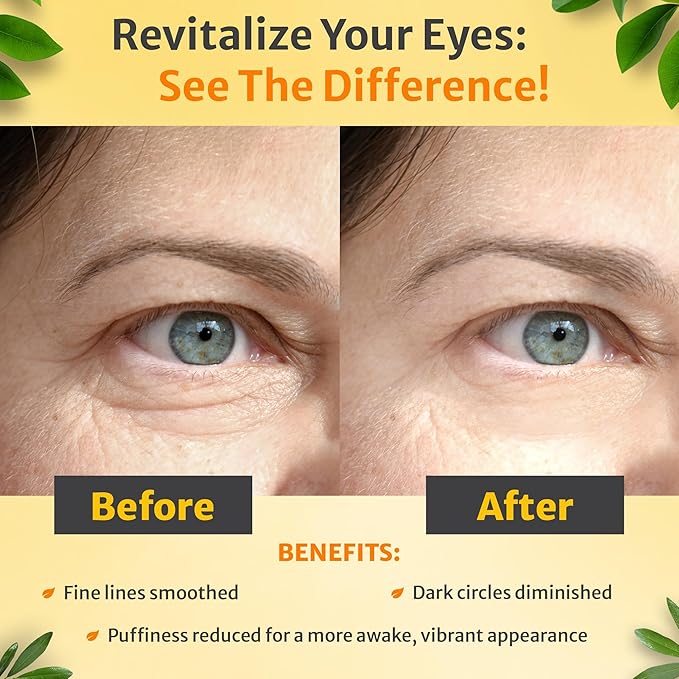 True Love Under Eye Cream for Wrinkles – Eye Cream for Puffiness and Bags under Eyes – Non-Greasy, Long-Lasting Comfort for All Skin Types.