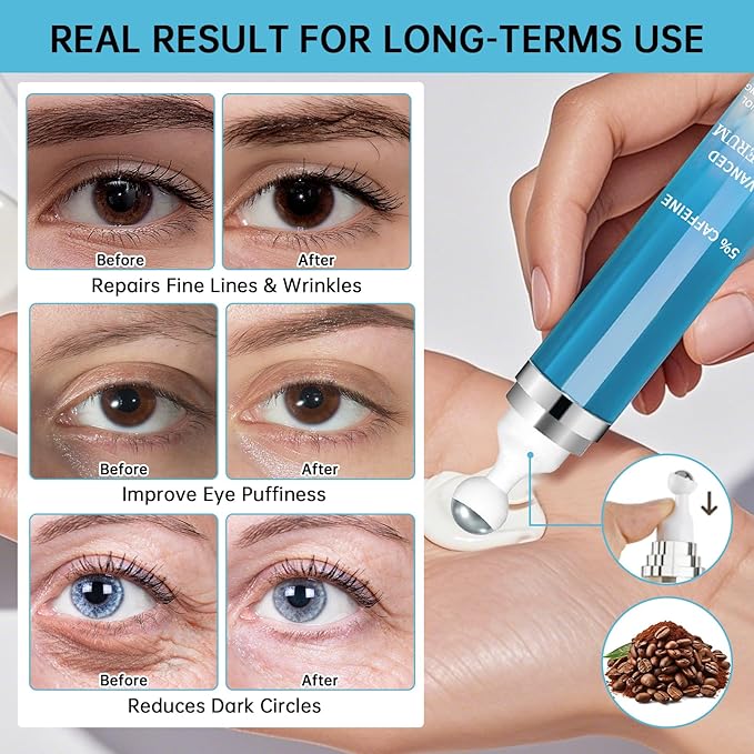 5% Caffeine Eye Cream Anti Aging, Eye Cream For Puffiness & Bags Under Eyes, 2 PCS Caffeine Eye Serum With Under Eye Roller For Wrinkles, Fine Lines & Dark Circles, Natural Eye Daily Care.