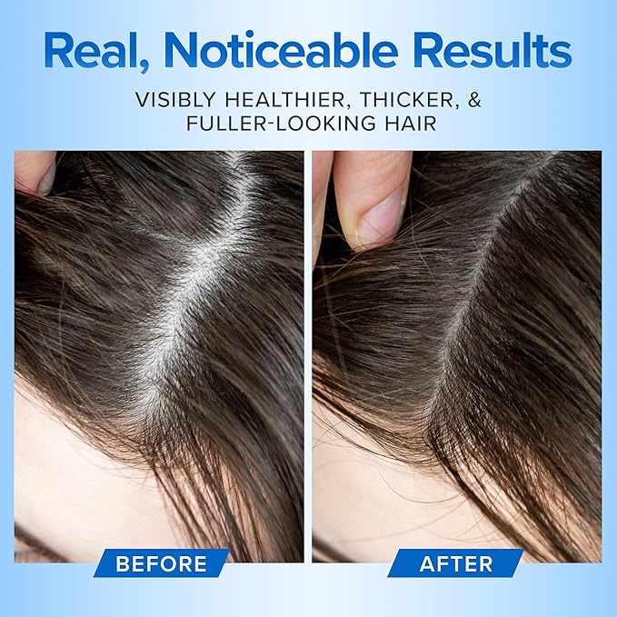 Natural Hair Growth Shampoo and Conditioner Set - Sulfate Free, Vegan, Thicker Hair Regrowth with Vitamins - Hair Loss & Thinning Products - Curly or Color Treated Hair - For Men and Women (16oz)