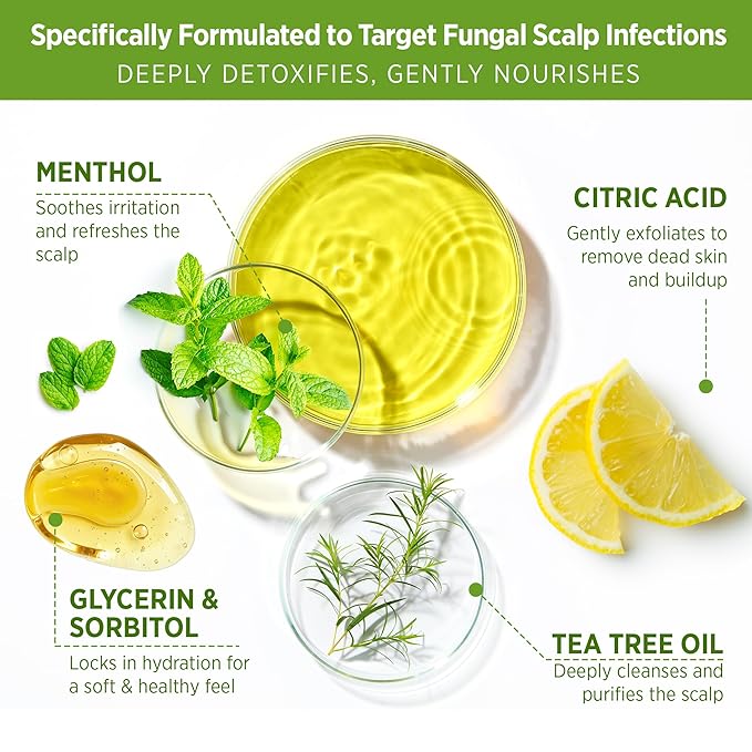 Roycederm Tea Tree Scalp Scrub: Anti Fungal Pre Shampoo, Itchy Relief Scalp Treatment for Dandruff, Psoriasis & Seborrheic Dermatitis - Gently Exfoliator, Relieves Dryness, Promotes Hair Growth