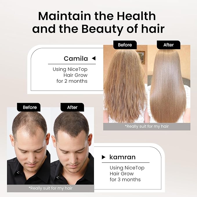 Hair Growth Supplement, Hair Care Support for Strength, Thickness Growth, with Biotin Vitamin A, C, E, Zinc, 60 Capsules